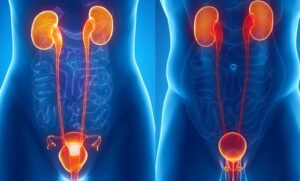 Lire la suite à propos de l’article TOUT SUR LA GONOCOCCIE.